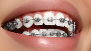 Orthodontist Colorado Springs